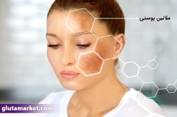 ملانین چیست؟